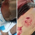 در شهر رشت اتفاق افتاد: حمله با چاقو به طلبه گیلانی ناهی از منکر/تصویر